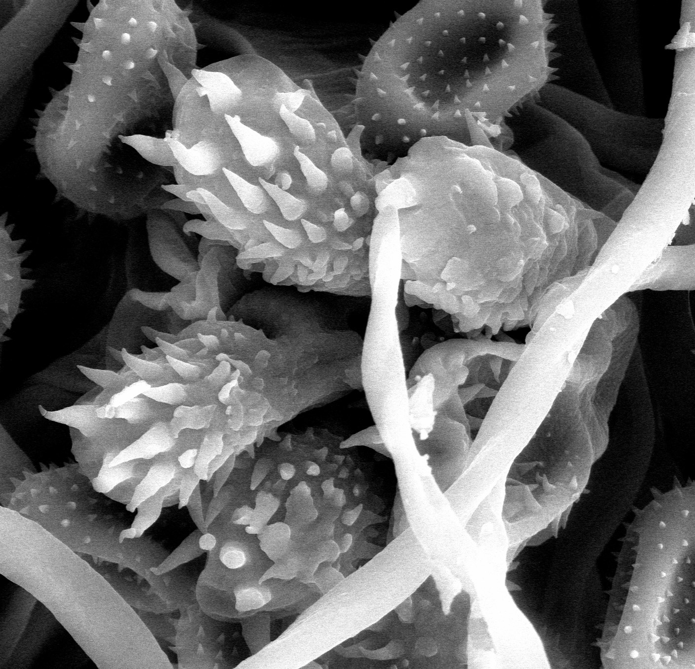 Sporenlager der Rostpilz-Gattung Aculeastrum die jüngst neu beschrieben wurde